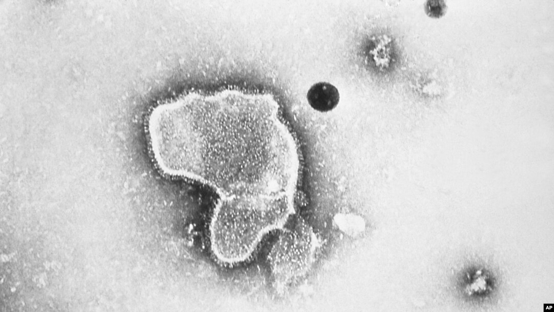 FILE - This 1981 photo shows Respiratory Syncytial Virus, also known as RSV. New research showed vaccinating pregnant women helped protect their newborns from the common but scary respiratory virus that fills hospitals with wheezing babies each fall. (CDC via AP, File)