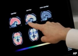 FILE - Dr. William Burke goes over a PET brain scan, Aug. 14, 2018, at Banner Alzheimers Institute in Phoenix.