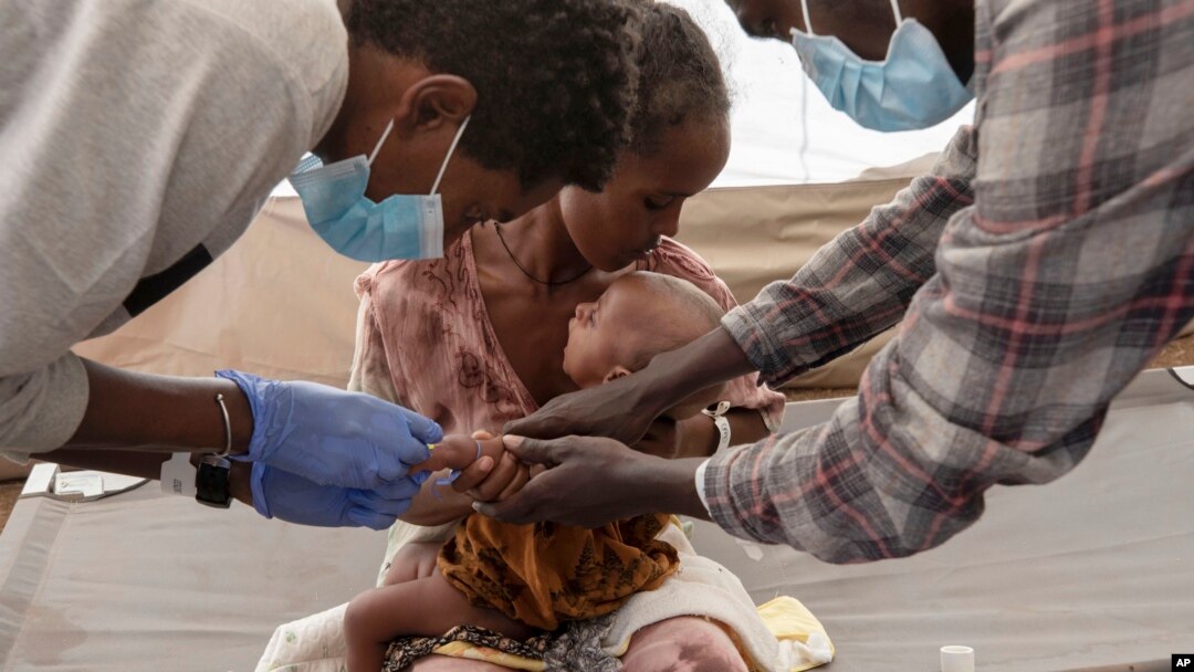 FILE - A Tigray woman who fled the conflict in Ethiopia's Tigray region holds her malnourished and severely dehydrated baby as nurses tend to him at a clinic in a Sudanese refugee camp on Dec. 5, 2020. Tigrayan authorities warn that the region faces a looming famine in 2024.