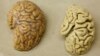 New Way of Defining Alzheimer's Aims to Find Disease Sooner